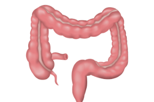 irritabel bowel